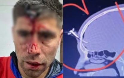 Le clavaron una llave en la cabeza a un jugador del Ascenso durante una salvaje pelea en un torneo de fútbol femenino