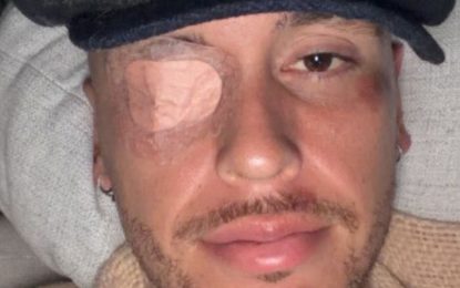 El delicado momento de salud de Lucas Ocampos: tras fracturarse, sufrió una parálisis facial y se pierde la pretemporada en México